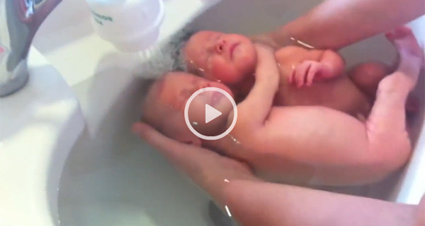 Video della settimana: l’abbraccio dei gemellini appena nati Video della settimana: l’abbraccio dei gemellini appena nati