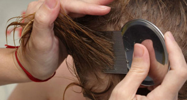 Pidocchi nei capelli: rimedi per debellarli definitivamente Pidocchi nei capelli: rimedi per debellarli definitivamente